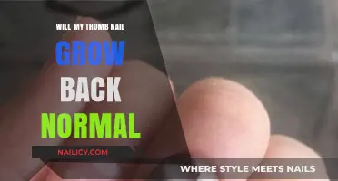How to Regrow a Thumb Nail Normally