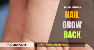 Toddler Nail Trauma: Will Nails Grow Back?