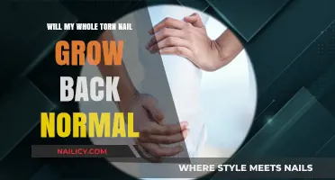 How to Heal a Torn Nail and Ensure Healthy Growth
