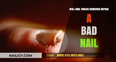 How to Fix a Bad Nail Job