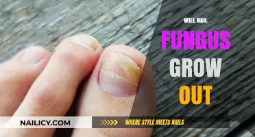 Nail Fungus: Can You Outgrow It?