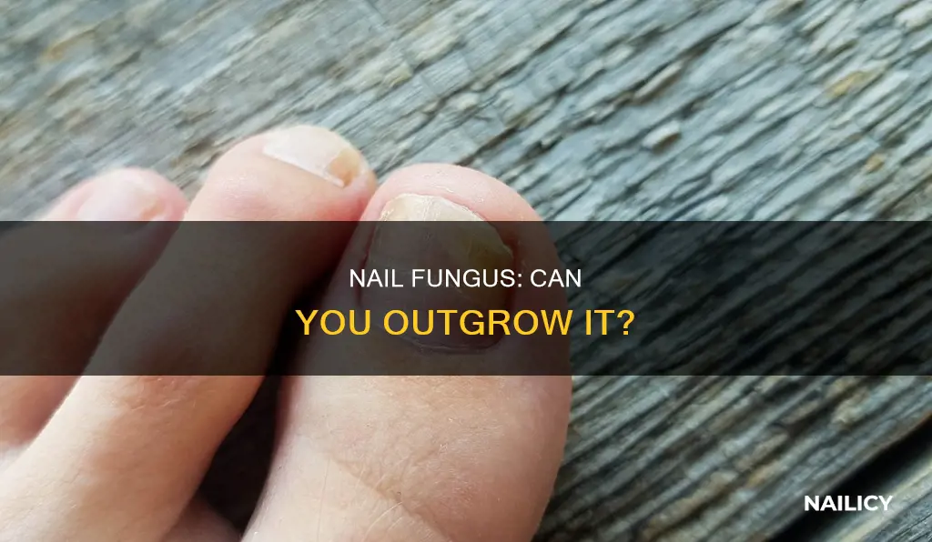 will nail fungus grow out
