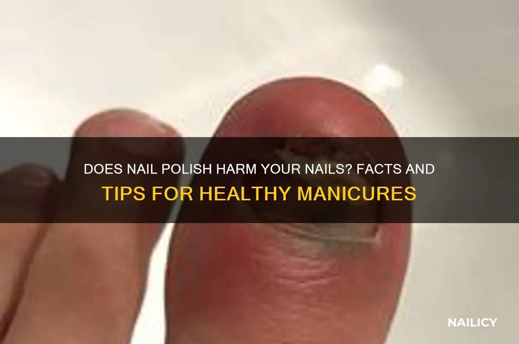 will nail polish damage my nails