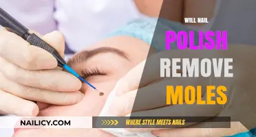 Nail Polish and Moles: What's the Truth?