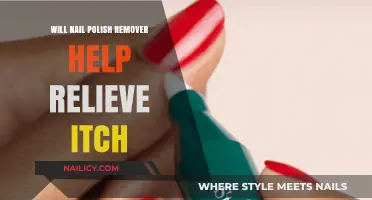 Nail Polish Remover: An Itch Relief Solution?