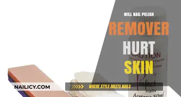 Nail Polish Remover: Skin Safe or Not?