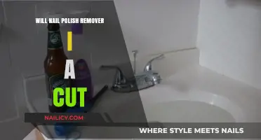 Nail Polish Remover: Cuts and Wound Care