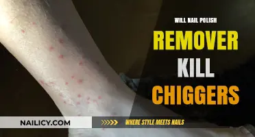 How to Kill Chiggers with Nail Polish Remover?