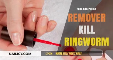 Nail Polish Remover: A Cure for Ringworm?