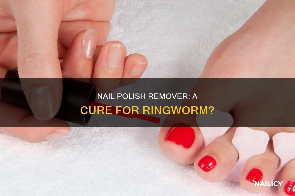 will nail polish remover kill ringworm