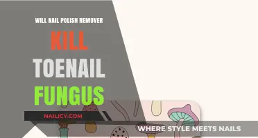Toenail Fungus Treatment: Nail Polish Remover as a Remedy?