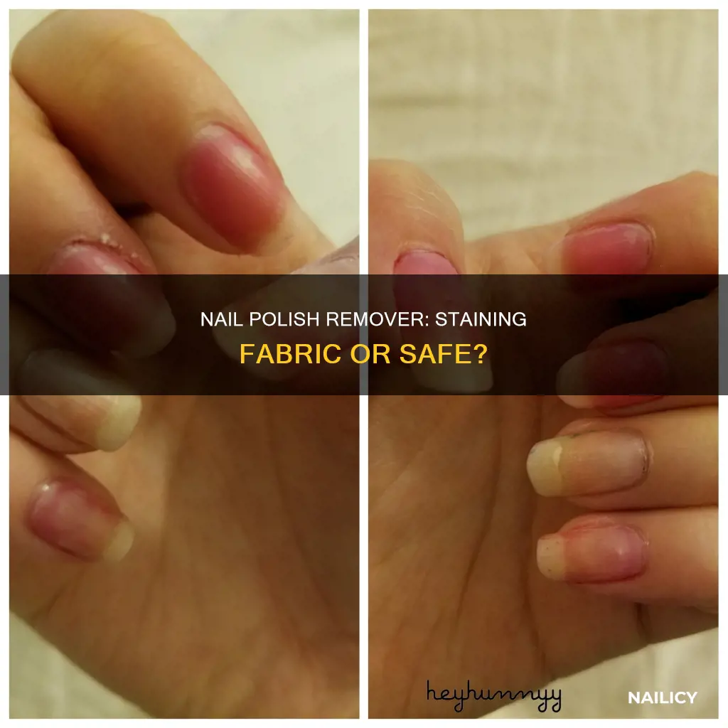 will nail polish remover stain fabric