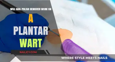 Nail Polish Remover: Effective Wart Treatment?