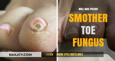 Can Nail Polish Smother Toe Fungus? Debunking Myths and Facts