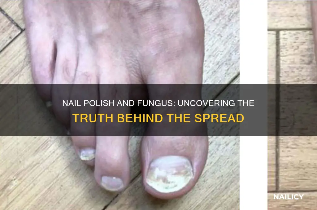 will nail polish spread fungus