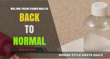 How to Restore Nail Polish Stained Nails to Their Natural Color