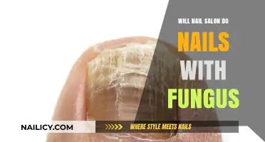 Nail Fungus Concerns: Should You Visit a Salon for Treatment?