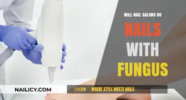Nail Fungus Concerns: Should Salons Treat Infected Nails?