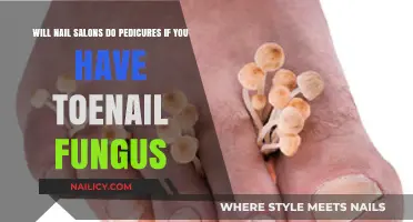 Toenail Fungus Concerns: Can You Still Get a Pedicure at a Nail Salon?
