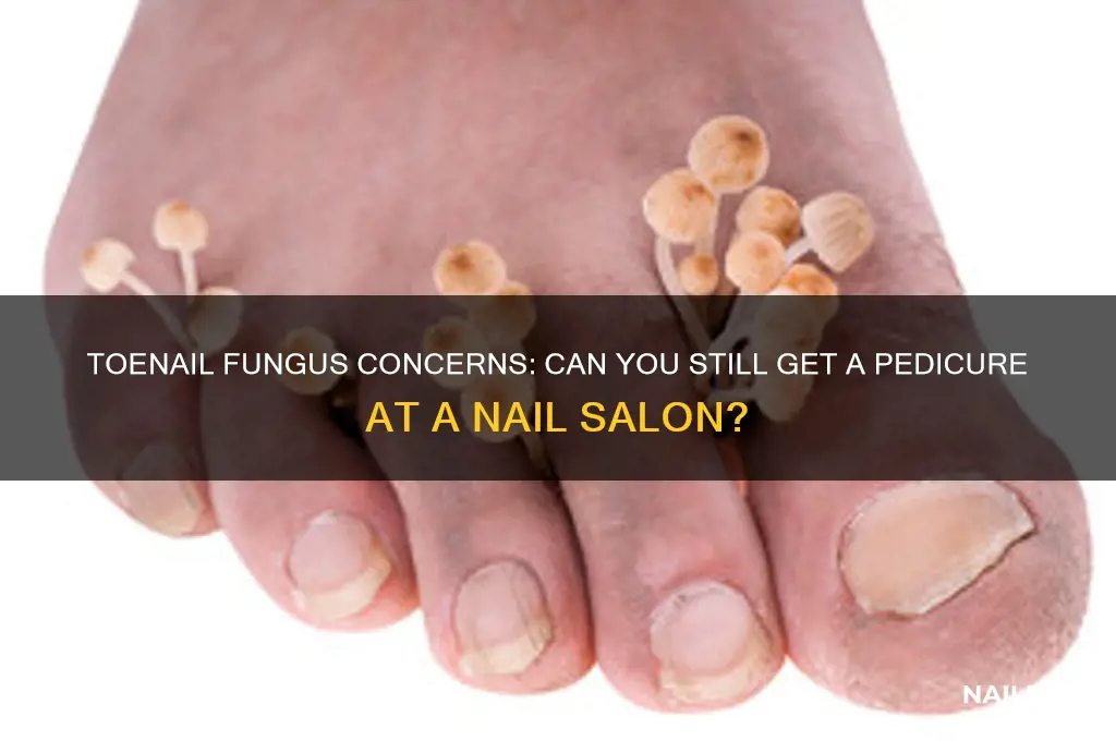 will nail salons do pedicures if you have toenail fungus