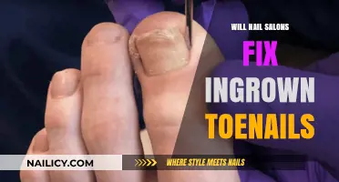 Can Nail Salons Safely Fix Ingrown Toenails? Expert Insights