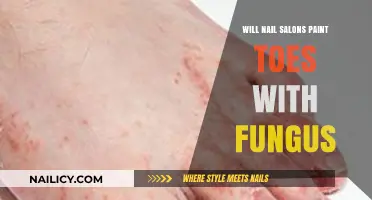 Should You Get a Pedicure if You Have Toenail Fungus?