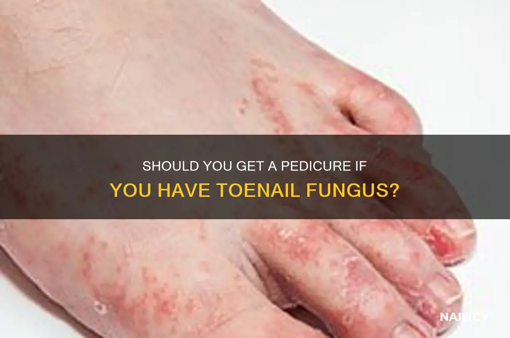 will nail salons paint toes with fungus