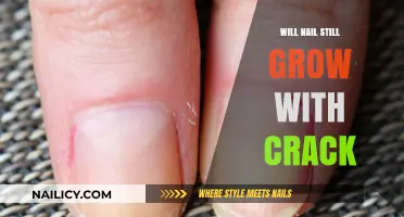 How to Manage Nail Growth with a Crack