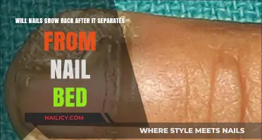 How to Recover Nails After They Separate From the Nail Bed
