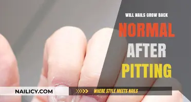Pitting Nails: Can They Regrow Healthy?