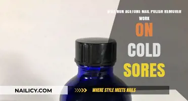 Nail Polish Remover: Cold Sore Treatment or Myth?
