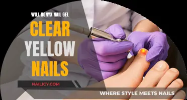 Nonyx Nail Gel: Effective Remedy for Yellow Nails?