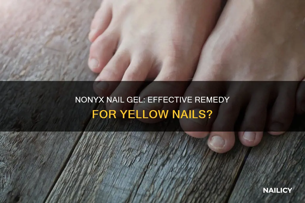 will nonyx nail gel clear yellow nails