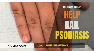 Nonyx Nail Gel: An Effective Treatment for Nail Psoriasis?