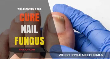 Killing Nail Fungus: Removing the Nail Isn't Enough