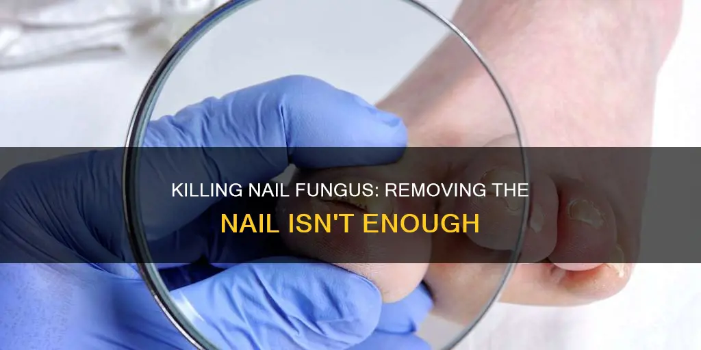 will removing a nail cure nail fungus
