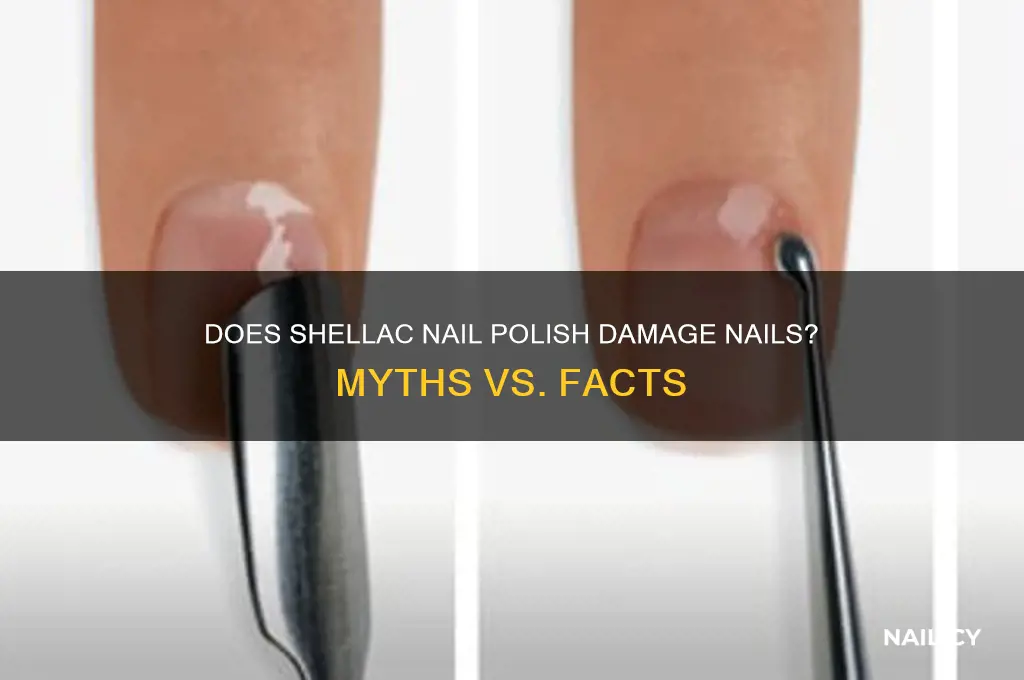 will shellac nail polish ruin my nails