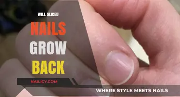 Sliced Nails: Can They Grow Back?