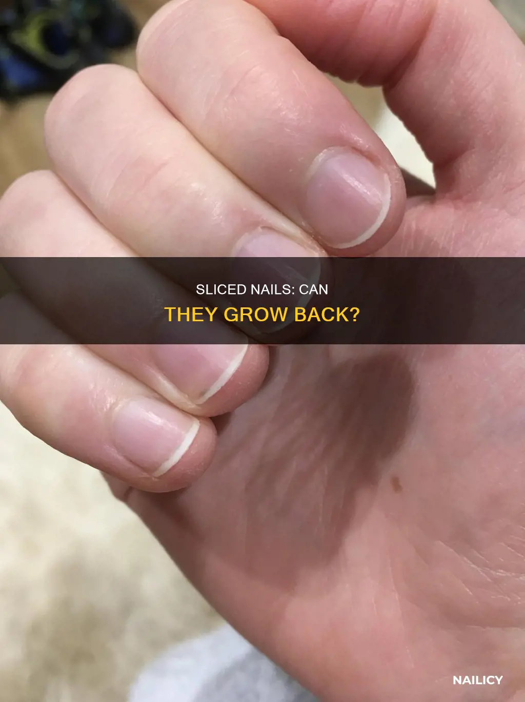 will sliced nails grow back