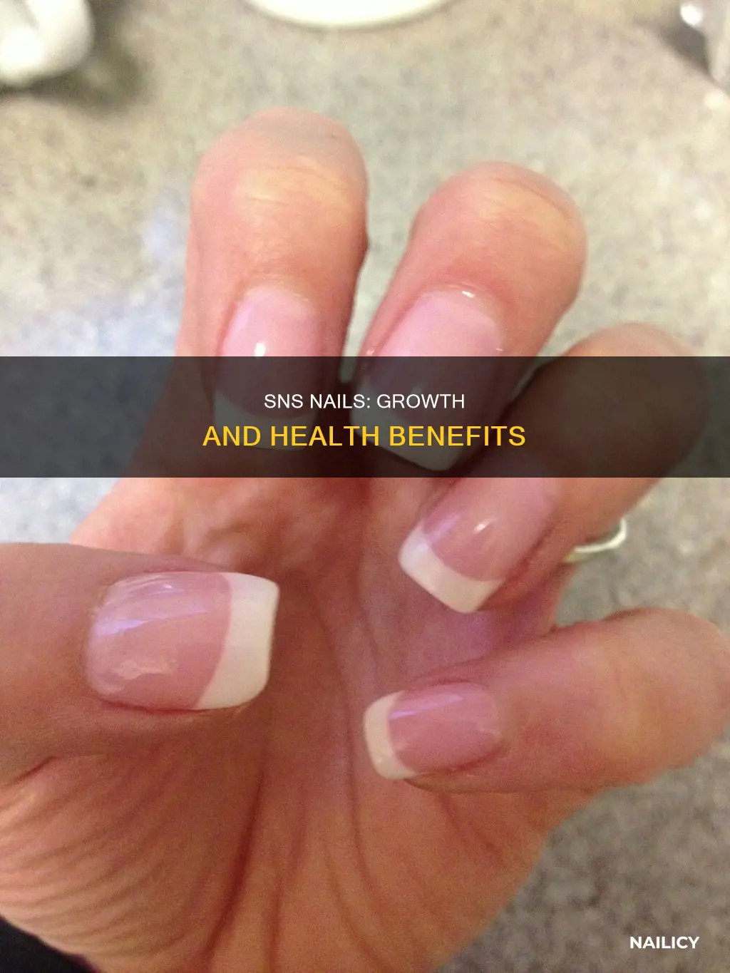 will sns help nails grow