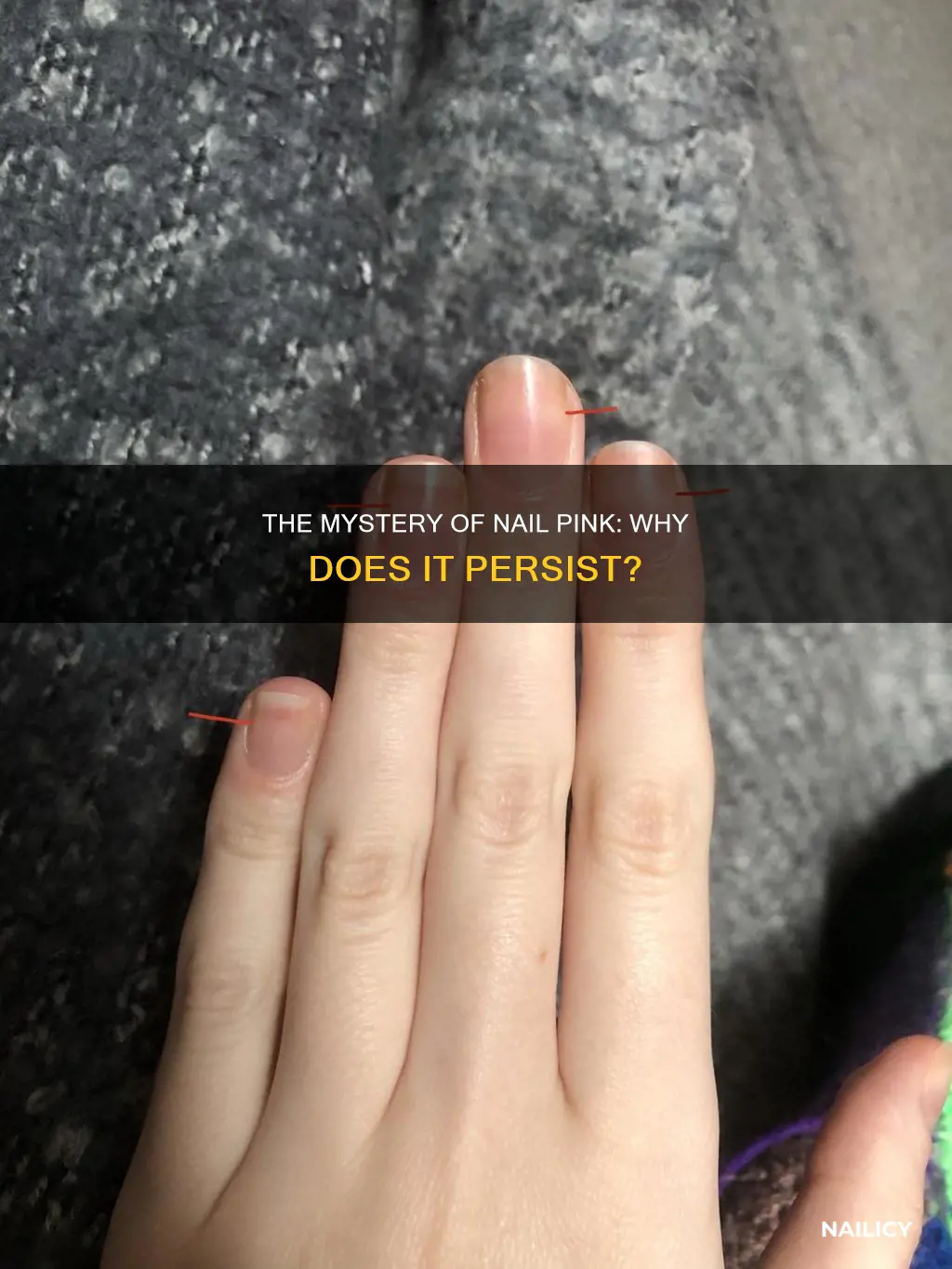 will the pink in your nails ever grow