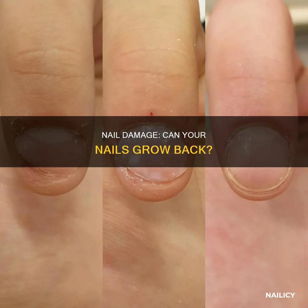 will the side of my nail grow back