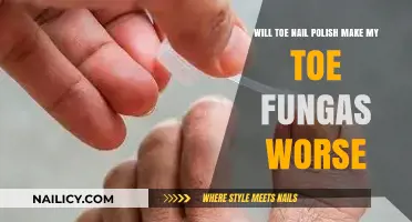 Toe Nail Polish and Fungus: Worsening Infection Risk Explained