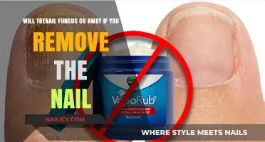 Toenail Fungus: Removal or Persistence?