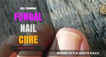 Trimming Fungal Nails: Can It Cure the Infection?