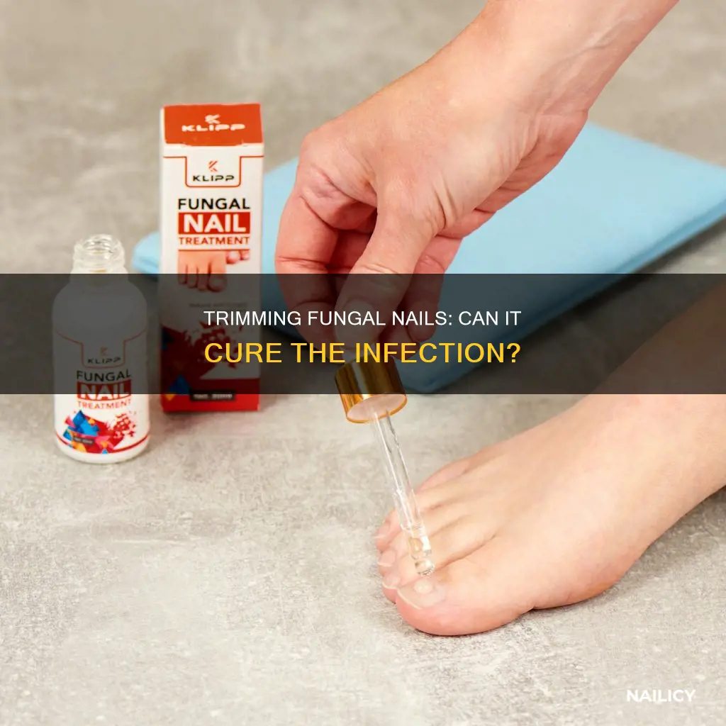 will trimming fungal nail cure