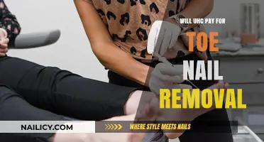 UH Coverage for Toenail Removal: What You Need to Know