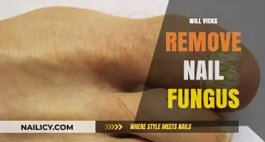 Vicks Vaporub for Nail Fungus: Does It Work?