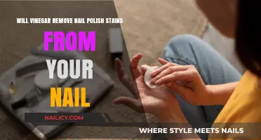 Can Vinegar Remove Nail Polish Stains?