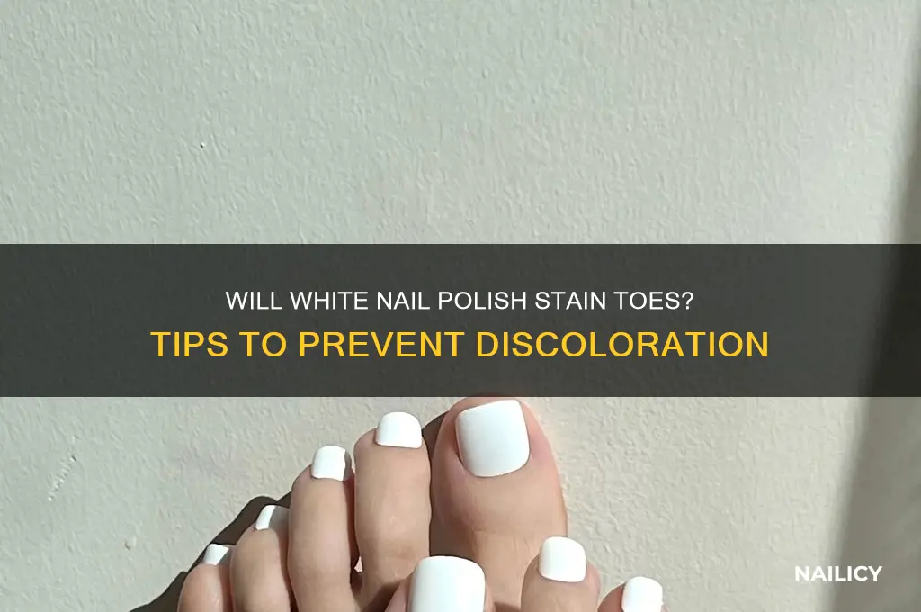 will white nail polish stain my toes